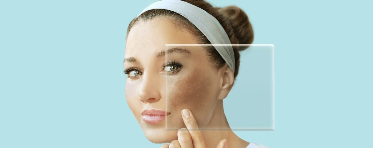 Comment savoir si vous avez la peau sèche, grasse ou sensible - et pourquoi c'est important
